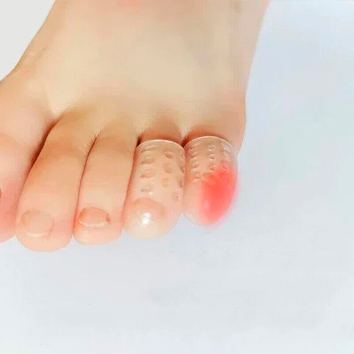 ToeProtector, silikonowe ochraniacze na palce (10 sztuk) - Image 8
